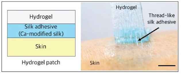 Figure 1. Schematic and photograph of a hydrogel patch adhered on the human skin through the silk adhesive