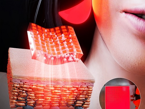 면 발광 마이크로 LED 패치 개발로 피부 미백에 획기적 효과 이미지
