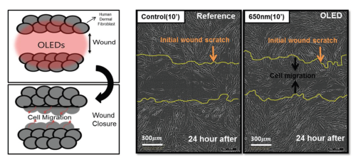 Figure 2. The migration of cells into the scratched area