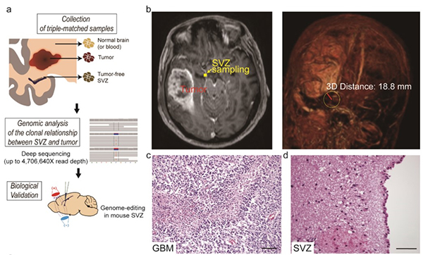 A Breakthrough for Understanding Glioblastoma: Origin Cells for Deadly Brain Tumors Identified 이미지2