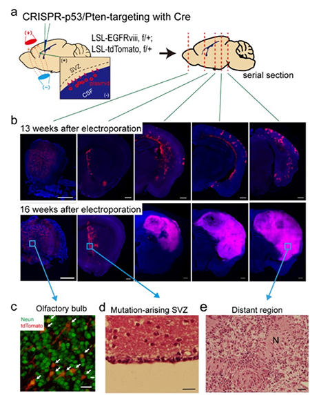 A Breakthrough for Understanding Glioblastoma: Origin Cells for Deadly Brain Tumors Identified 이미지3