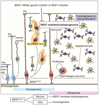 BRAF V600E 돌연변이가 발생하여 뇌전증 동반 소아 뇌종양을 유발하는 과정 모식도