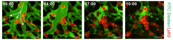 KAIST Identifies the Cause of Sepsis-induced Lung Injury 이미지3