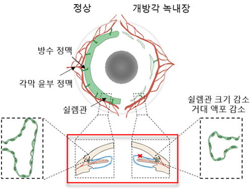 고규영 교수, 녹내장 발생에 관여하는 신호전달체계 규명 이미지