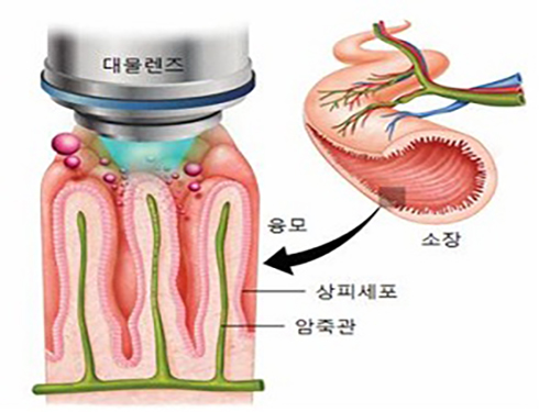 소장 내 지방 흡수과정의 비밀 밝혀 이미지