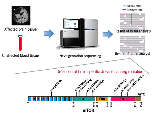 Mutations Occurring Only in Brain Responsible for Intractable Epilepsy Identified 이미지