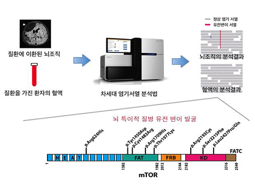 약물로 조절되지 않는 뇌전증(간질) 원인 밝혀 이미지