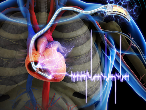 The First Demonstration of a Self-powered Cardiac Pacemaker 이미지