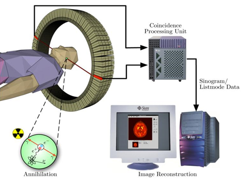 The key to Alzheimer disease, PET-MRI made in Korea 이미지