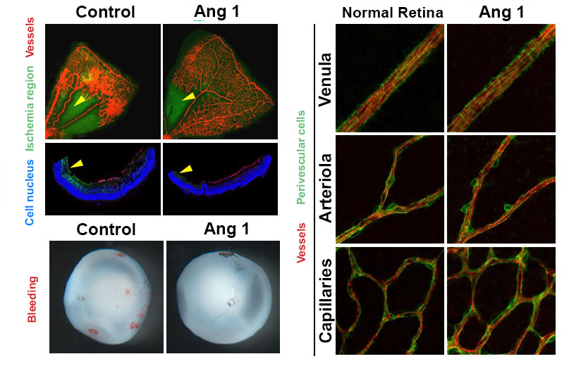 Therapy developed to induce Angiogenesis of Retina 이미지