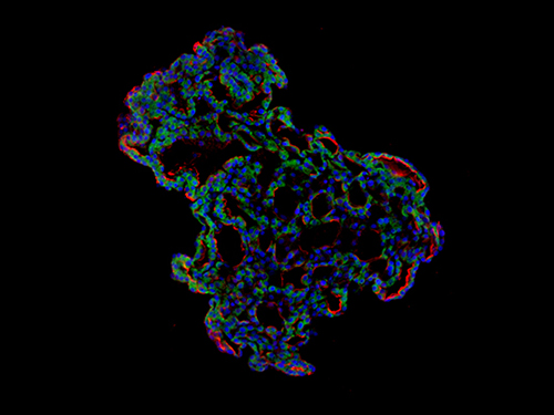 'Mini-Lungs' Reveal Early Stages of SARS-CoV-2 Infection 이미지