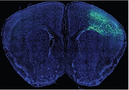 A Mechanism Underlying Most Common Cause of Epileptic Seizures Revealed 이미지