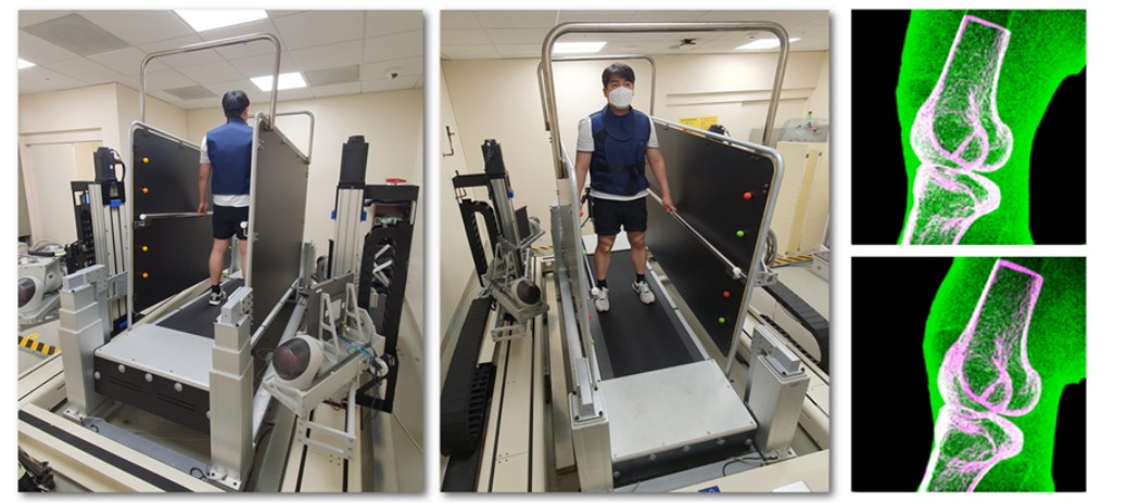 Prof. Seungbum Koo’s Team Receives Clinical Biomechanics Award at the 30th International Society of Biomechanics Conference 이미지