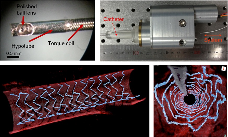 High Resolution 3D Blood Vessel Endoscope System Developed 이미지