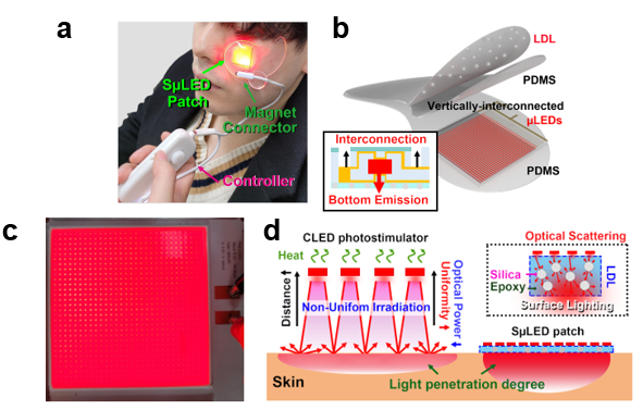 (1) The overall concept of SµLED patch