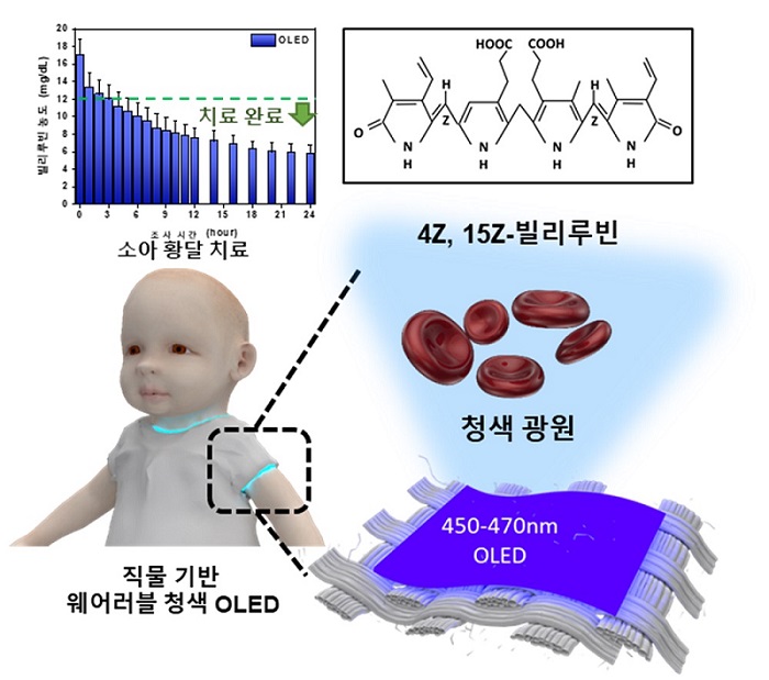 그림 1. 직물기반 웨어러블 청색 OLED 에 의한 신생아 황달 치료 개념도