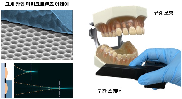 그림 1. 고체 잠입 마이크로렌즈 어레이 및 구강 스캐너와 구강 모형 사진