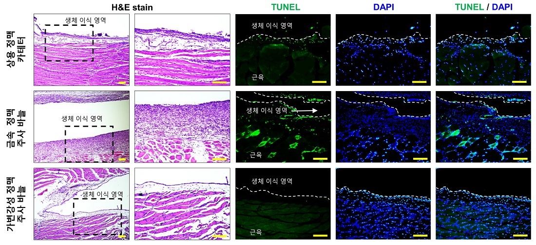 그림 3. 가변강성 정맥 주사바늘의 생체 적합성 검증: H&E와 TUNEL 테스트를 통해 상용 정맥 주사바늘과 개발된 가변강성 정맥 주사바늘의 생체 적합성 비교  