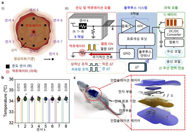 실시간 상처 모니터링 시스템의 개략도